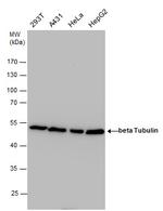 beta Tubulin Antibody in Western Blot (WB)