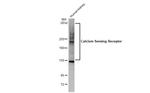 Calcium Sensing Receptor Antibody in Western Blot (WB)