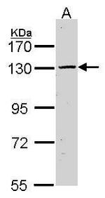 Calcium Sensing Receptor Antibody in Western Blot (WB)