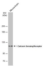 Calcium Sensing Receptor Antibody in Western Blot (WB)