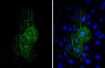 ACE2 Antibody in Immunocytochemistry (ICC/IF)