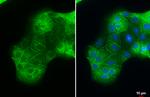 ACE2 Antibody in Immunocytochemistry (ICC/IF)