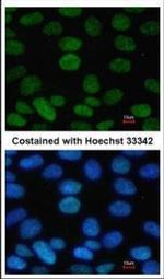 SOX2 Antibody in Immunocytochemistry (ICC/IF)