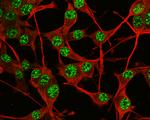 SOX2 Antibody in Immunocytochemistry (ICC/IF)