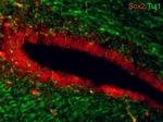 SOX2 Antibody in Immunohistochemistry (Frozen) (IHC (F))