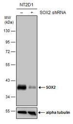 SOX2 Antibody in Western Blot (WB)