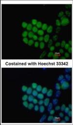 SOX2 Antibody in Immunocytochemistry (ICC/IF)