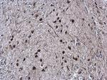 SOX2 Antibody in Immunohistochemistry (Paraffin) (IHC (P))