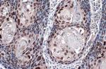 SOX2 Antibody in Immunohistochemistry (Paraffin) (IHC (P))