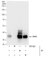 SOX2 Antibody in Immunoprecipitation (IP)