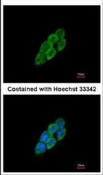 LTBP4 Antibody in Immunocytochemistry (ICC/IF)