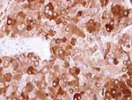 LTBP4 Antibody in Immunohistochemistry (Paraffin) (IHC (P))