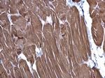 alpha-Cardiac Actin Antibody in Immunohistochemistry (Paraffin) (IHC (P))