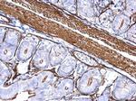 alpha-Cardiac Actin Antibody in Immunohistochemistry (Paraffin) (IHC (P))