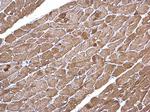 alpha-Cardiac Actin Antibody in Immunohistochemistry (Paraffin) (IHC (P))