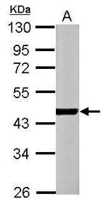 alpha-Cardiac Actin Antibody in Western Blot (WB)