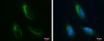 GRP78 Antibody in Immunocytochemistry (ICC/IF)