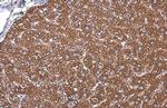 GRP78 Antibody in Immunohistochemistry (Paraffin) (IHC (P))