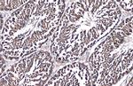 GRP78 Antibody in Immunohistochemistry (Paraffin) (IHC (P))