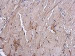 VEGF Antibody in Immunohistochemistry (Paraffin) (IHC (P))