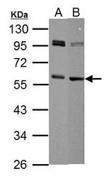 c-Myc Antibody in Western Blot (WB)