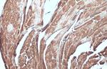 Desmin Antibody in Immunohistochemistry (Paraffin) (IHC (P))