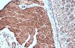 Desmin Antibody in Immunohistochemistry (Paraffin) (IHC (P))