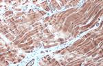 Desmin Antibody in Immunohistochemistry (Paraffin) (IHC (P))