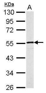 Desmin Antibody in Western Blot (WB)