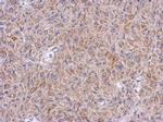 ALDH7A1 Antibody in Immunohistochemistry (Paraffin) (IHC (P))