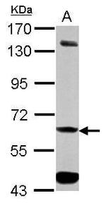 ALDH7A1 Antibody in Western Blot (WB)