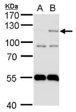 HIF-2 alpha Antibody in Western Blot (WB)