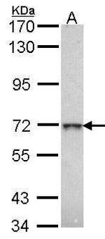 GLB1 Antibody in Western Blot (WB)