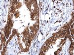 MMP2 Antibody in Immunohistochemistry (Paraffin) (IHC (P))