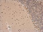 CSB Antibody in Immunohistochemistry (Paraffin) (IHC (P))