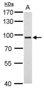 STAT3 Antibody in Western Blot (WB)