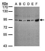 STAT3 Antibody in Western Blot (WB)