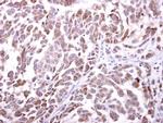 NKG2D Antibody in Immunohistochemistry (Paraffin) (IHC (P))