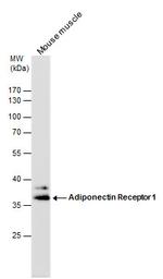 Adiponectin Receptor 1 Antibody in Western Blot (WB)