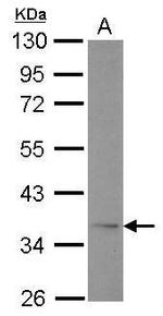 Adiponectin Receptor 1 Antibody in Western Blot (WB)