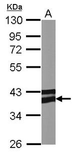 Adiponectin Receptor 1 Antibody in Western Blot (WB)