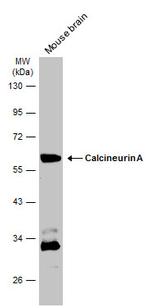 Calcineurin A Antibody in Western Blot (WB)