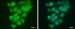 LOXL2 Antibody in Immunocytochemistry (ICC/IF)