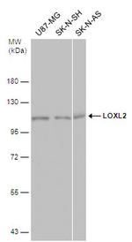 LOXL2 Antibody in Western Blot (WB)