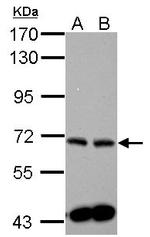 SPHK2 Antibody in Western Blot (WB)