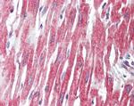 PLCL1 Antibody in Immunohistochemistry (Paraffin) (IHC (P))