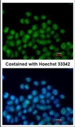 Nkx2.5 Antibody in Immunocytochemistry (ICC/IF)