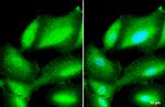 L-Plastin Antibody in Immunocytochemistry (ICC/IF)