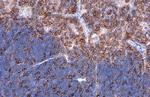 L-Plastin Antibody in Immunohistochemistry (Paraffin) (IHC (P))