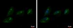 ENPP2 Antibody in Immunocytochemistry (ICC/IF)